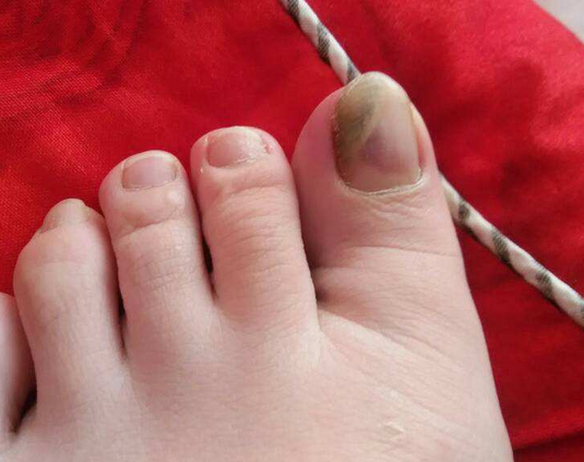 Ϊʲôһ�������ָ�׾���ʧ�ˣ����ƻ�ָ�׻�����Ҫע��ʲô�أ�