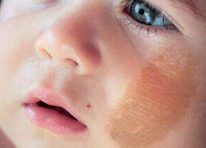 �ൺ�ļ�ҽԺ��̥�Ǻã�̥�ǵ���Ҫ���ͺ�֢״����Щ��