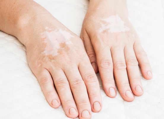 �ൺ���ư�����õ�ҽԺ������ᴫȾ��