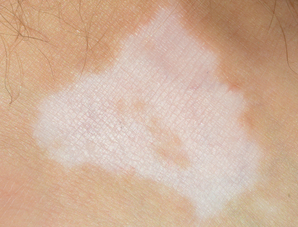 ������ڸ���ô���أ�Ƥ����ҽԺǰ�ڰ���3�����Ʒ�ʽ����