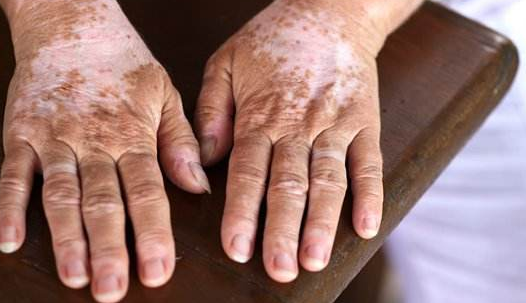 ����ж��Լ��Ƿ��а����أ���������Ϊʲô���ױ����ӣ�