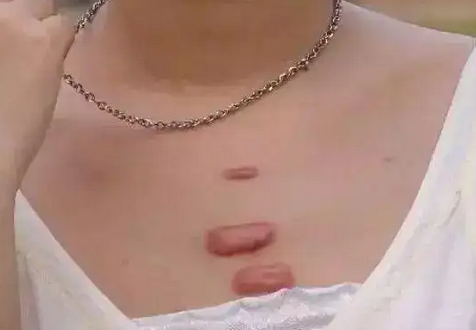 <a href='/' target='_blank' title='�ൺƤ����ҽԺ'><span style='color: #0000ff'><strong>�ൺƤ����ҽԺ</strong></span></a>�̺۵�3��Σ�������������԰̺�4������