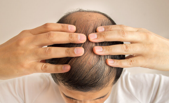 <a href='/' target='_blank' title='�ൺƤ����ҽԺ'><span style='color: #0000ff'><strong>�ൺƤ����ҽԺ</strong></span></a>�����ѷ�����Ҫ�ɿ�4��ʳ��