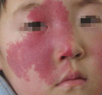 ÇൺƤ·ô²¡Ò½Ôº