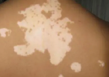 �ൺ����ҽԺ���������ƣ��ൺ����ҽԺ��Ҫע��3��