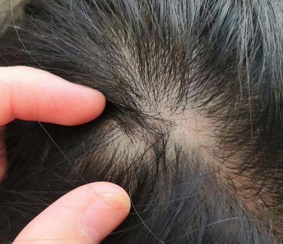 Ӧ�����ѡ��ҽԺ�أ��ൺ�ļ�ҽԺ����ë���ף�