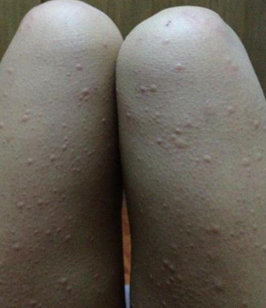 ���������㡿�ൺ�����ݡ����ҽԺ�ȽϺã�