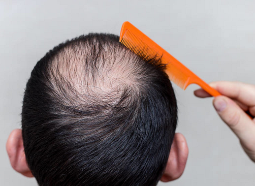 ���ѷ���־��ÿ������������ͷ�����ѷ��ı�־��