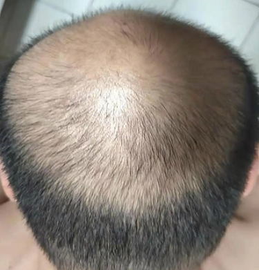 ���ѷ�ר���ص㹫������Щʳ�������ڷ�ֹ�ѷ��������ൺ�ѷ��о�Ժ