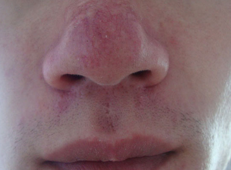 Ϊʲô��þ����ǣ��ൺ�Ʋ۱�Ƥ����ҽԺ���а�ǰʮλ����һ��