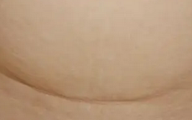 ���ַ���ȥ���ʸ����̺ۺã��ൺƤ����ʮ��ҽԺ������-�ൺ�����